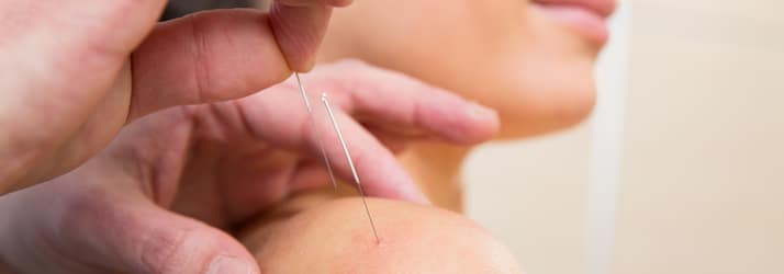 Acupuncture in Elgin IL